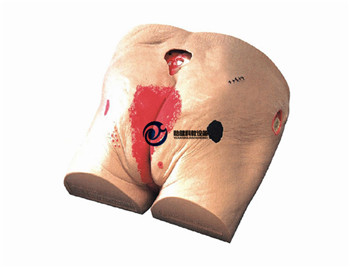 高級壓瘡(褥瘡)護理模型