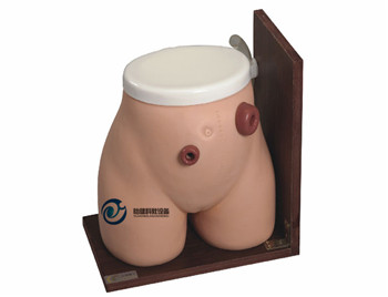 高級瘺管造口術護理模型