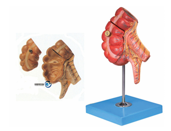 盲腸和闌尾模型