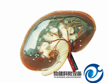 透明腎臟放大模型