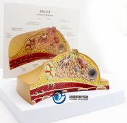 乳房病理解剖模型