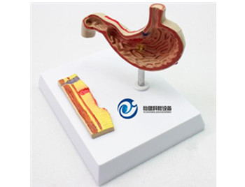 病理胃模型